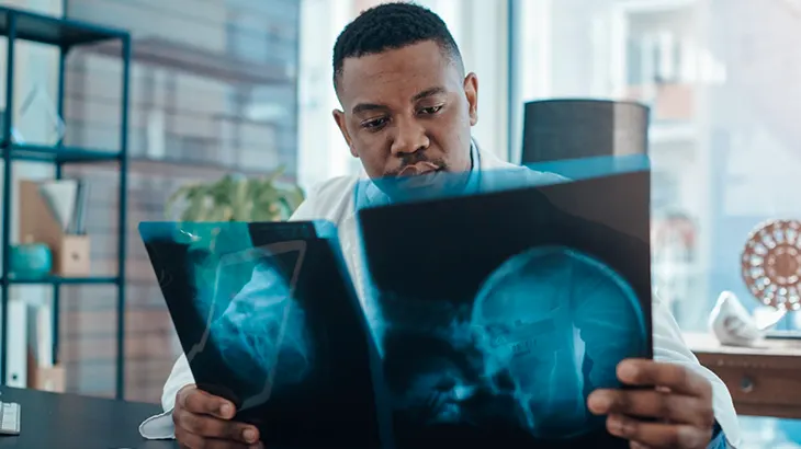 Médico segurando radiografia do cérebro